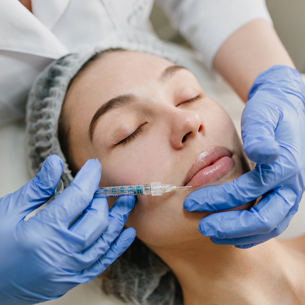 Injection d’acide hyaluronique dans les lèvres